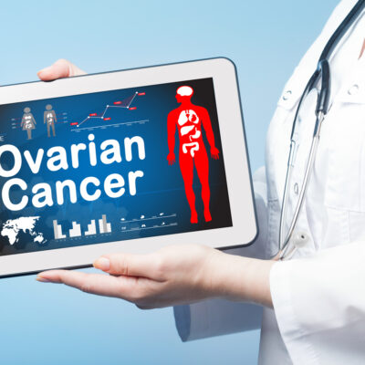 Ovarian Cancer &#8211; Symptoms and Treatment Methods