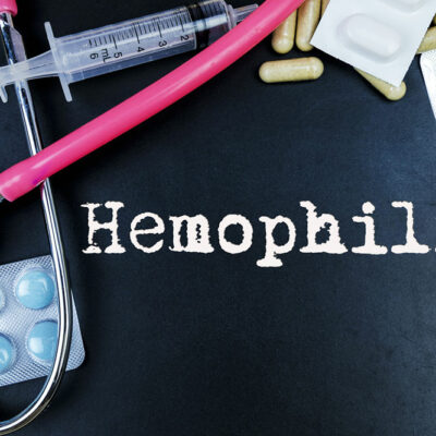 Symptoms, Diagnosis and Treatments for Hemophilia