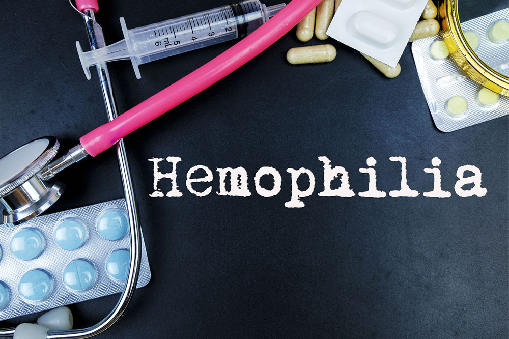 Symptoms, Diagnosis and Treatments for Hemophilia